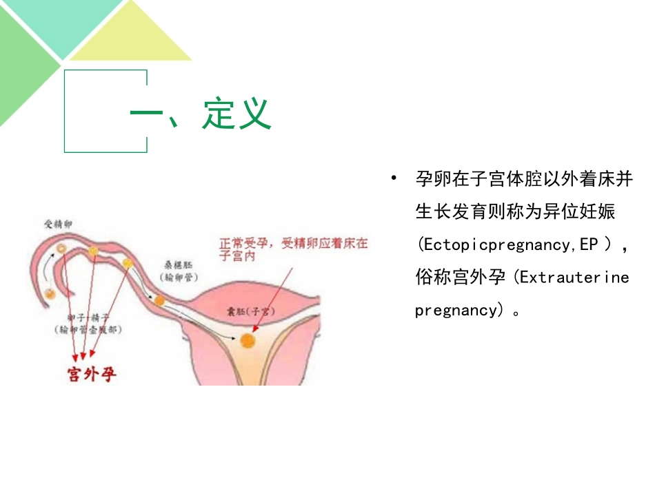 腹腔镜异位妊娠病灶清除术讲解_第2页