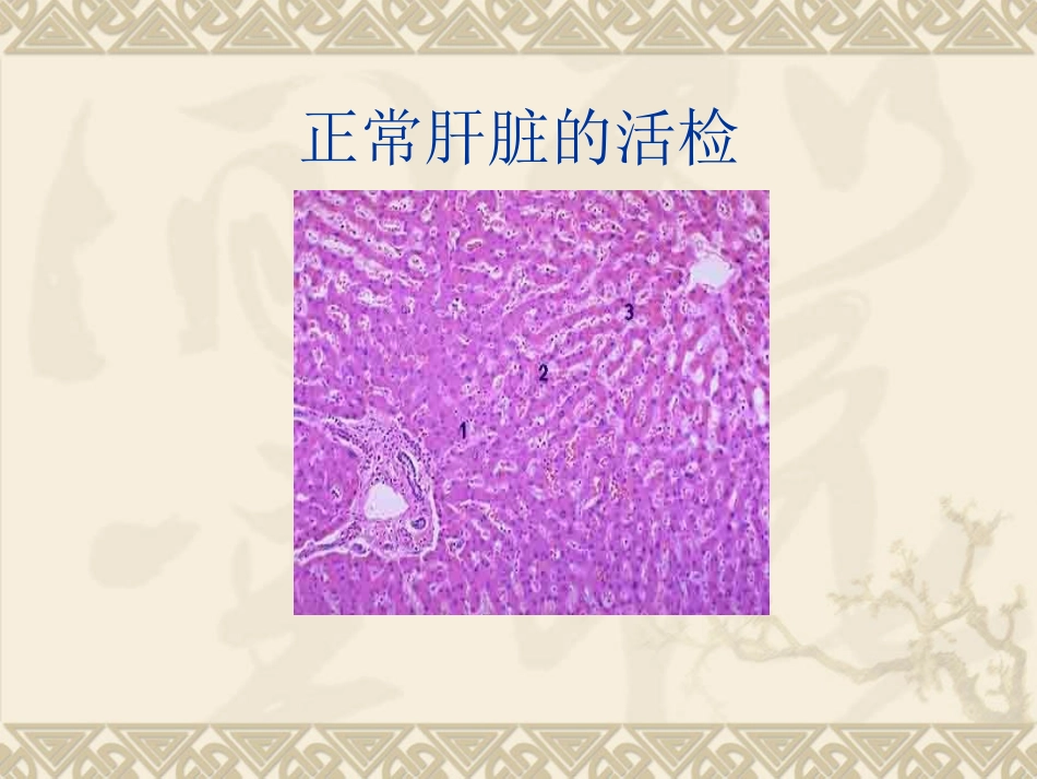 肝穿刺活检术的护理_第2页