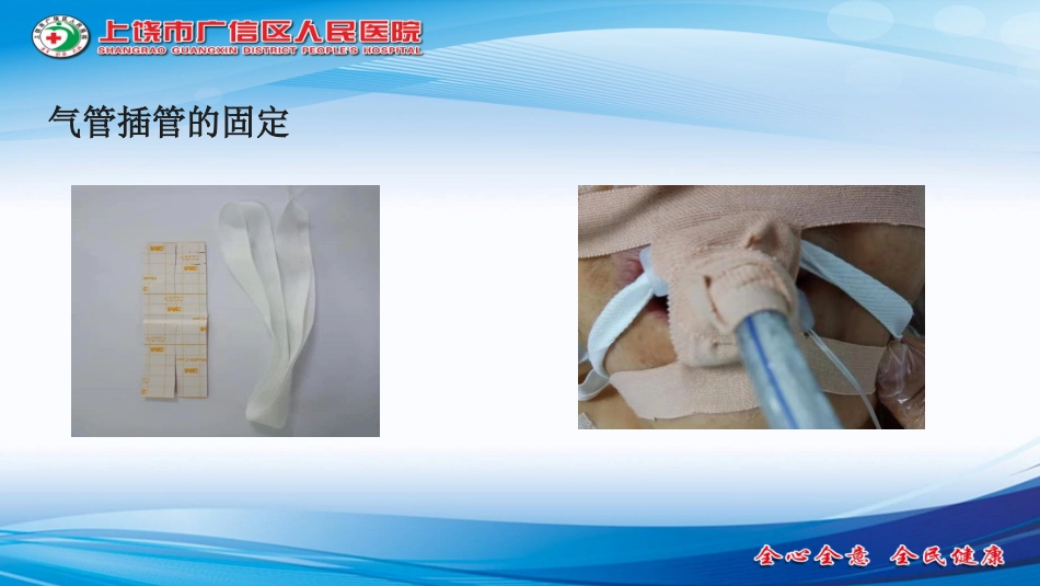 各种导管的有效固定_第3页