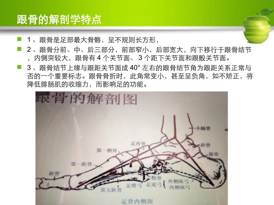 跟骨骨折护理查房课件_第3页