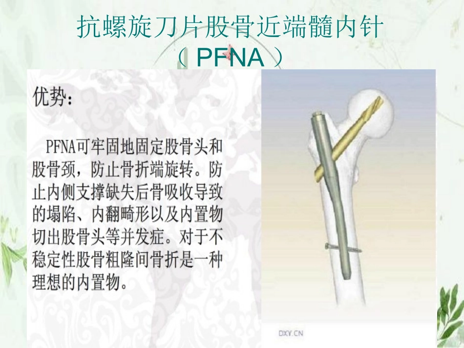 股骨粗隆间骨折手术配合图文_第2页