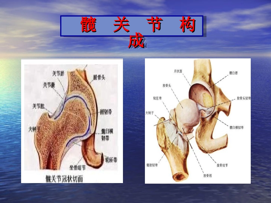 股骨颈骨折空心钉内固定选择详解_第2页