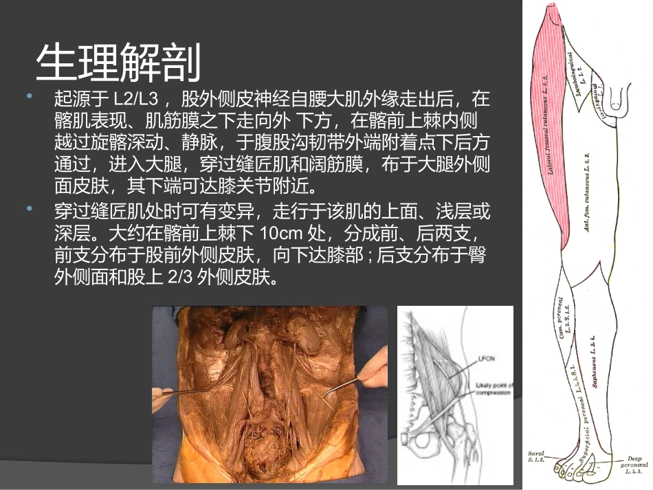 股外侧皮神经压卡综合征_第3页