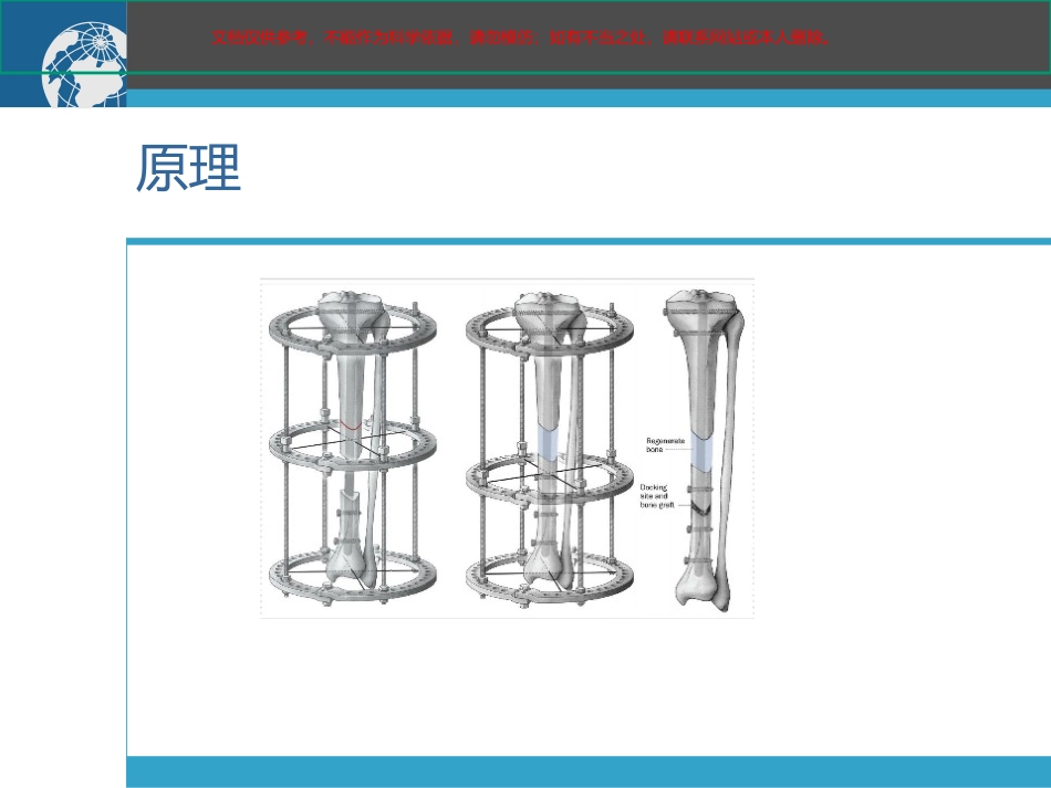 骨搬运医学知识课件_第3页
