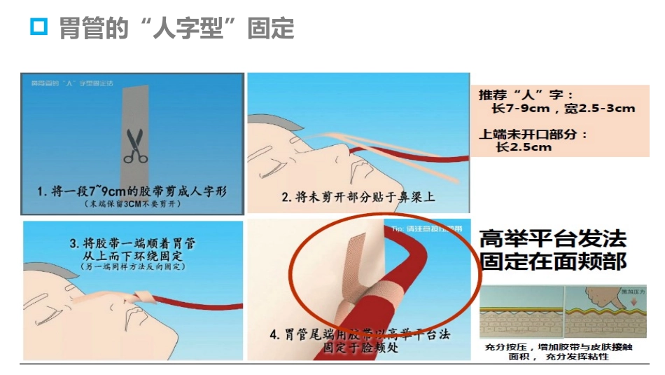 管道固定刘落_第3页