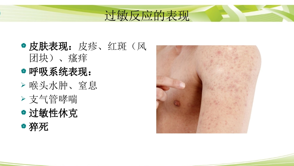过敏性休克的急救最全_第3页