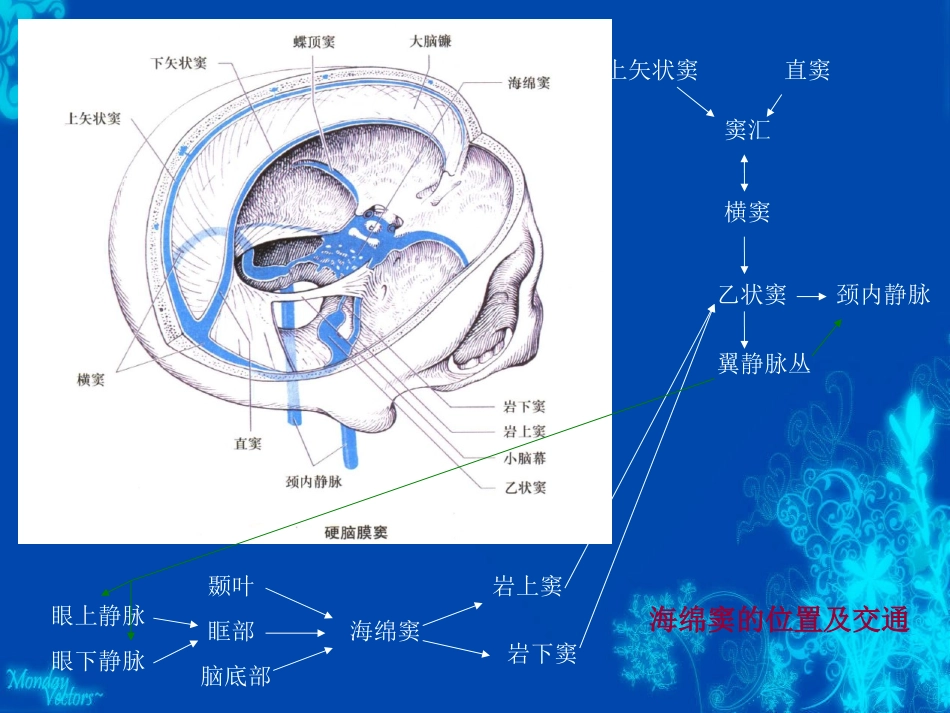 海绵窦综合征眶上裂综合征及眶尖综合征_第3页