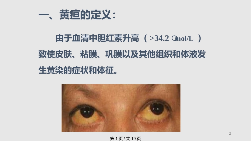 黄疸课件教案_第2页