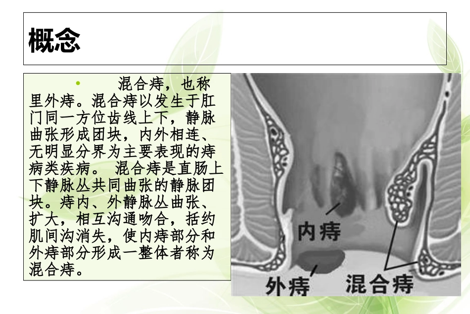 混合痔健康教育培训课件_第2页