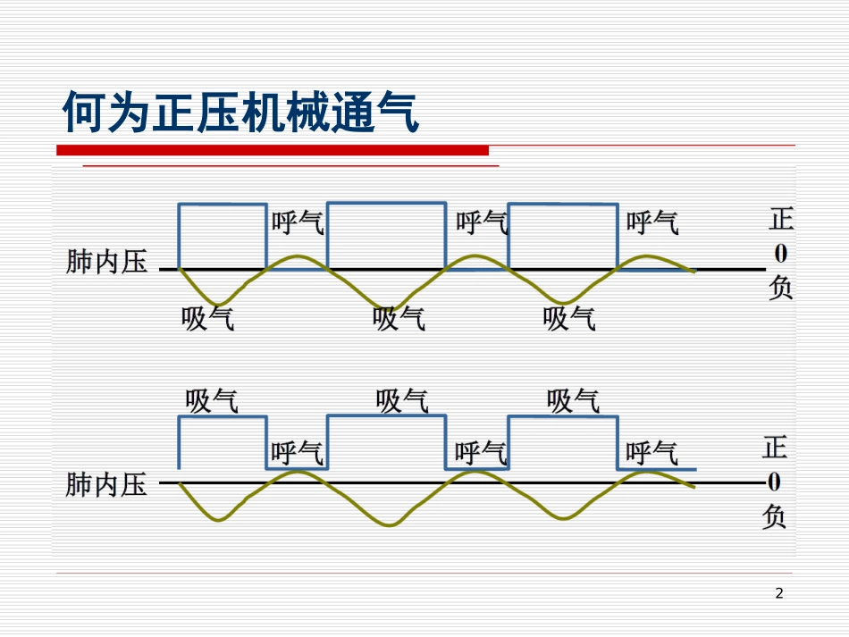 机械通气模式_第2页
