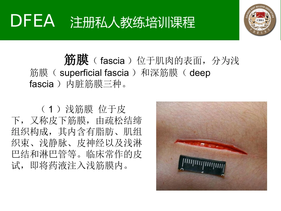 肌筋膜手法康复课程课件_第3页