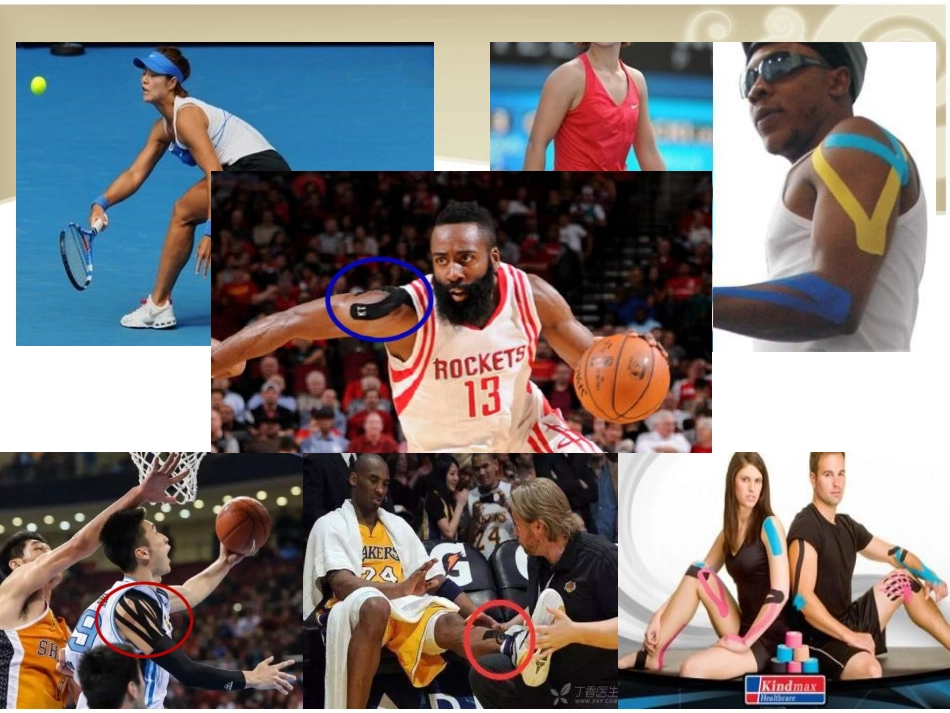 肌内效贴布胡金鲁_第2页