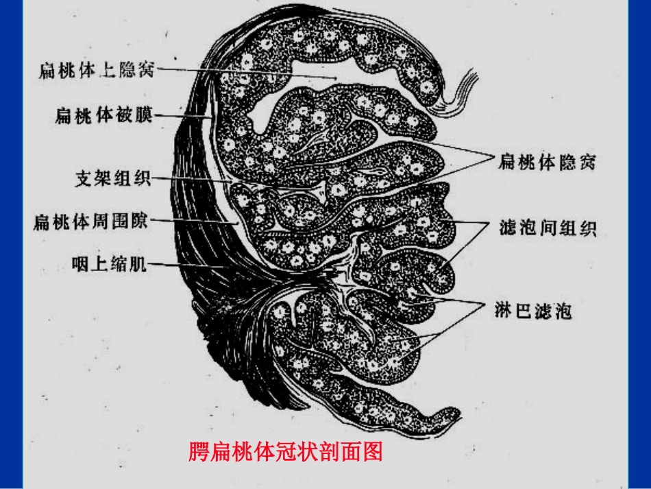 急性扁桃体炎课件_第3页