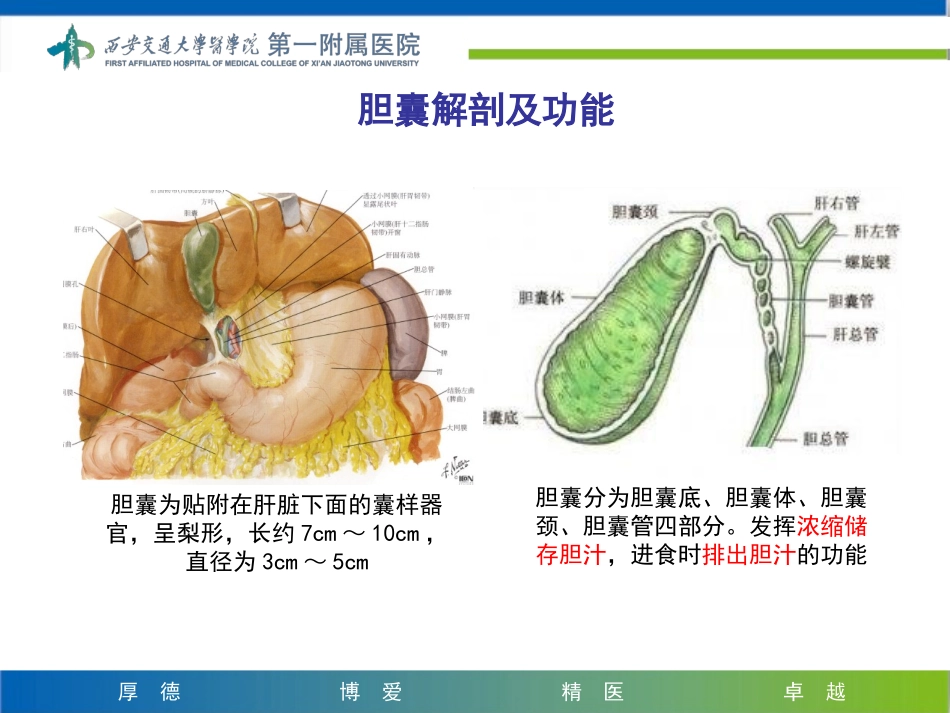 急性胆囊炎上传版_第2页