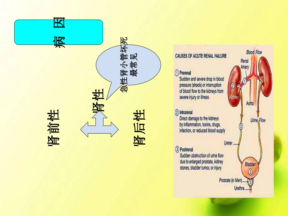 急性肾衰竭血液透析医疗护理查房讲义_第2页