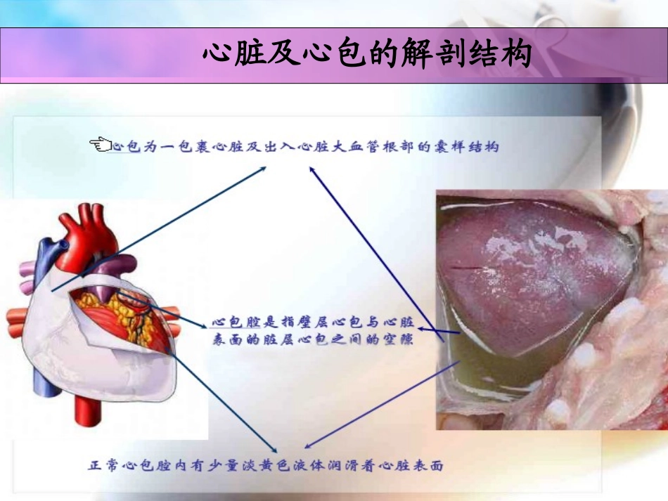 急性心包填塞观察和护理_第3页