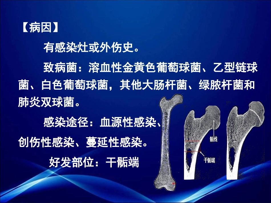 急性血源性骨髓炎_第3页