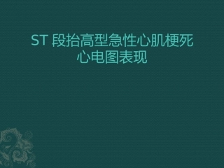 急性右冠回旋支病变心梗心电图