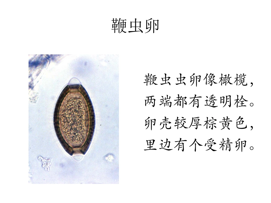 寄生虫学虫卵经典总结与图片_第3页