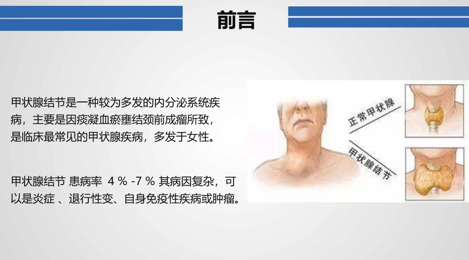 甲状腺结节的诊疗及治疗_第2页