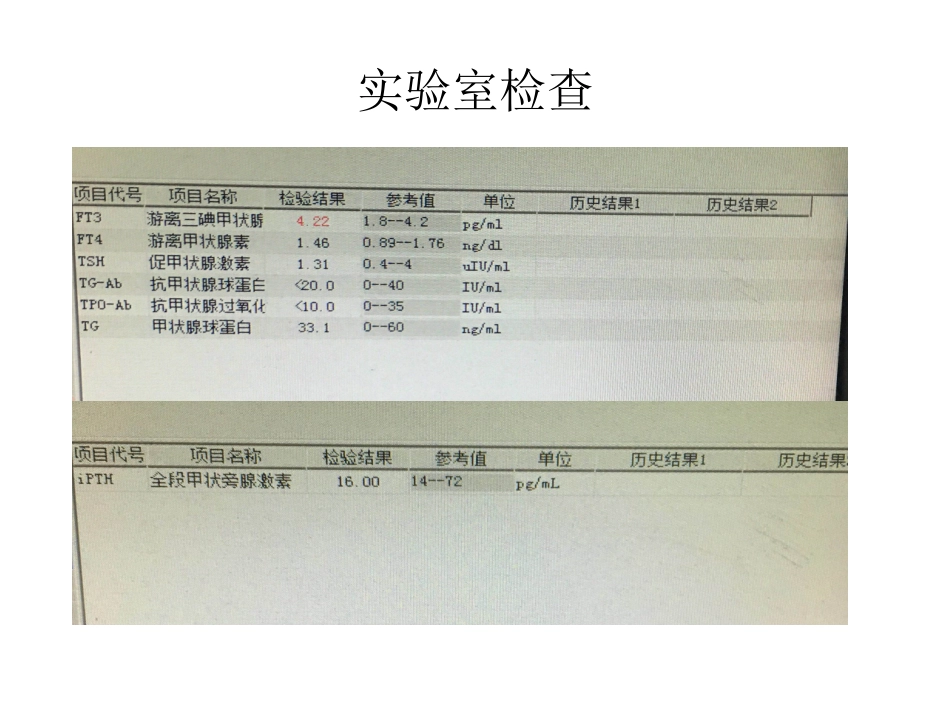 甲状腺髓样癌_第3页