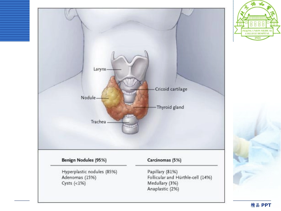 甲状腺髓样癌的治疗和护理_第2页