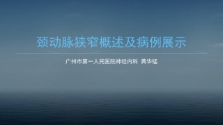 颈动脉狭窄概述和病例