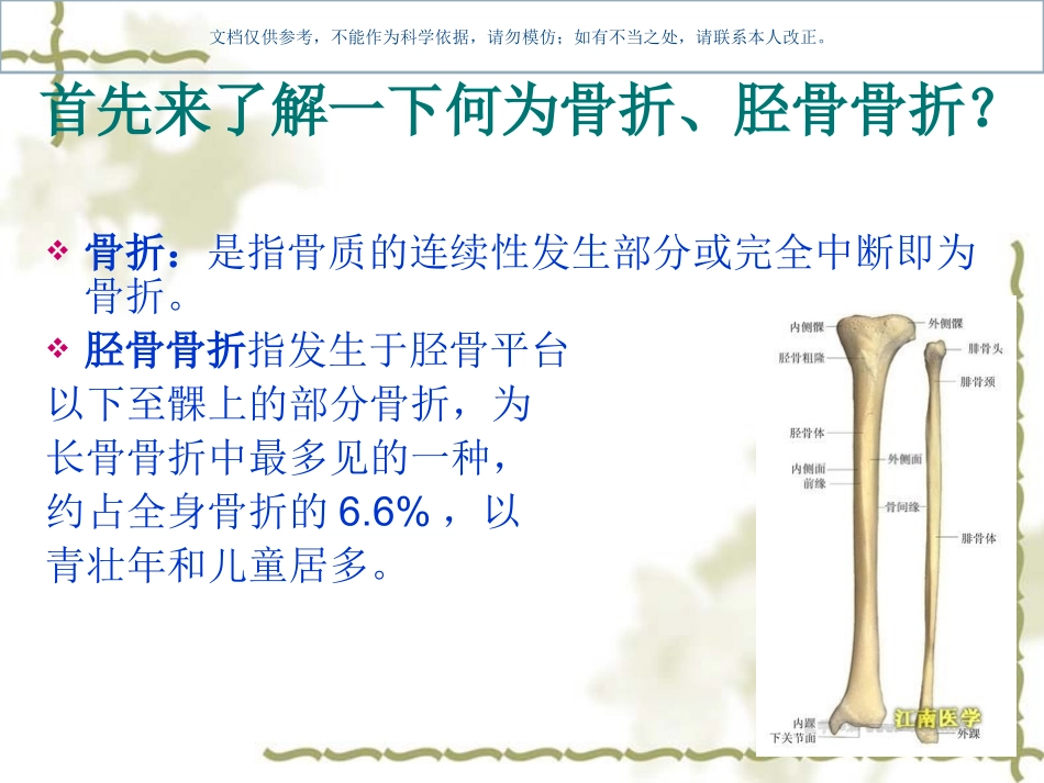 胫骨骨折的护理查房课件_第2页