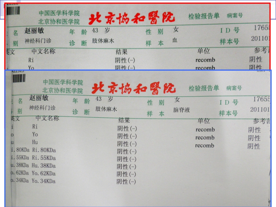抗神经元抗体_第1页