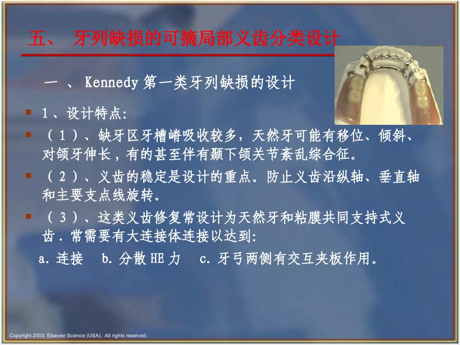 可摘局部义齿的分类设计_第1页