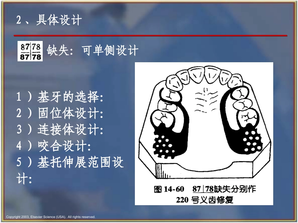 可摘局部义齿的分类设计_第3页