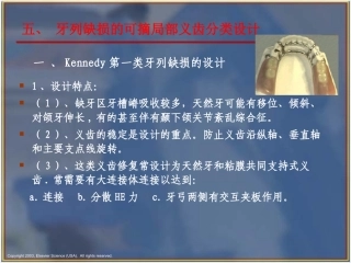 可摘局部义齿的分类设计