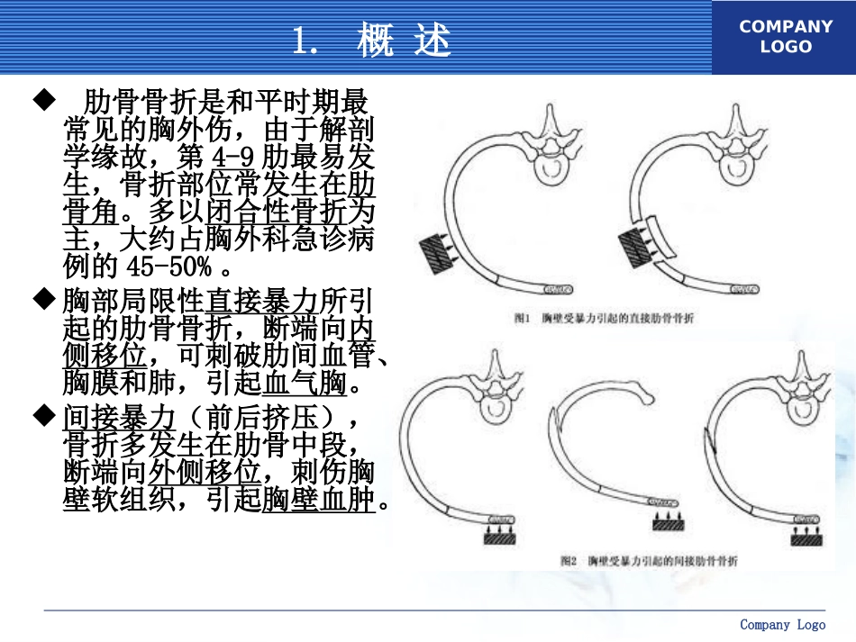 肋骨骨折的外科治疗_第3页