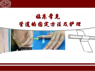 临床常见管道的固定方法及标识