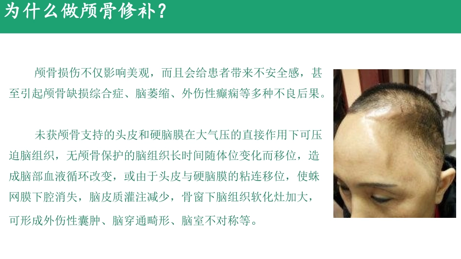 颅骨修补术围手术期的护理_第3页