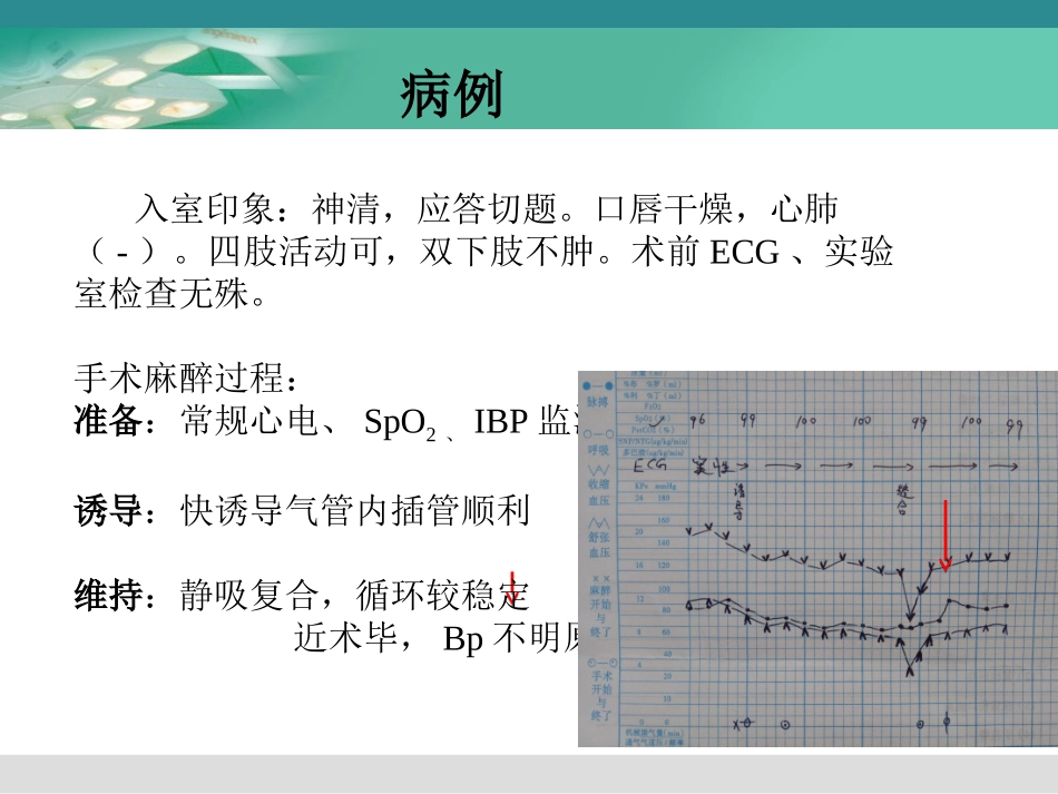 颅内动脉瘤介入栓塞术的麻醉管理_第3页