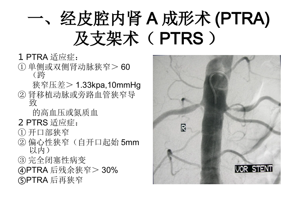 泌尿生殖系介入放射学_第3页