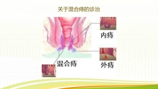 培训课件混合痔
