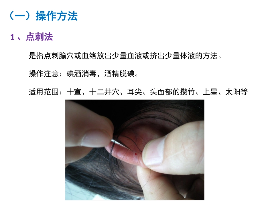皮肤针法三棱针法_第2页