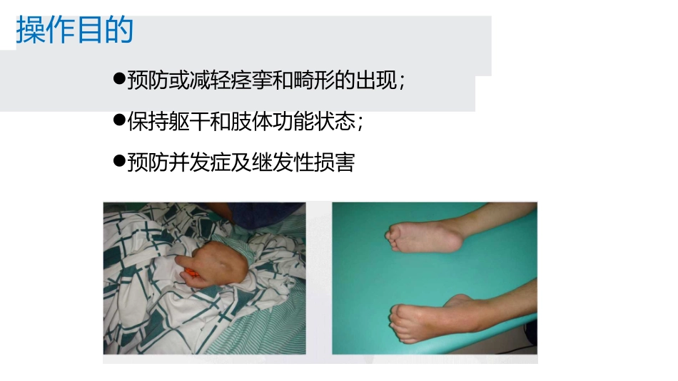 偏瘫患者抗痉挛体位摆放_第3页