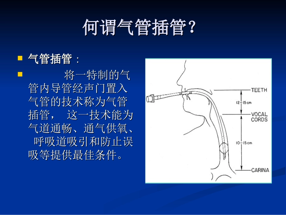 气管插管护理配合_第2页