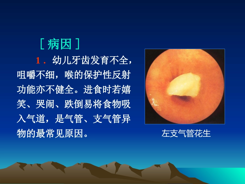 气管支气管异物_第3页