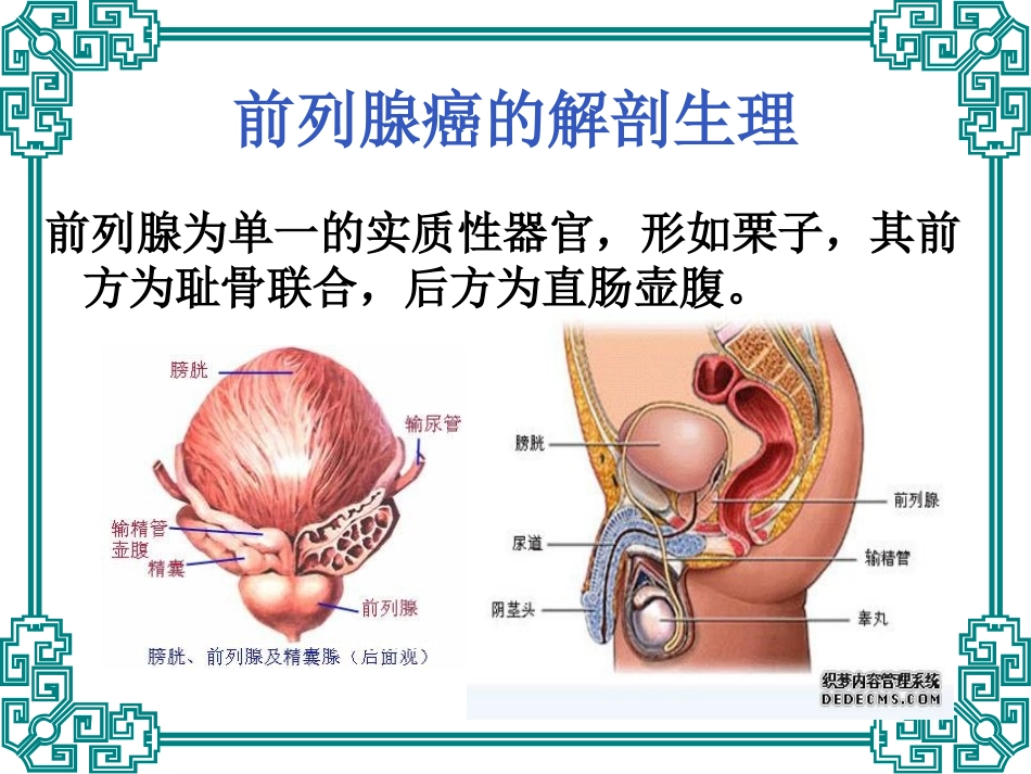 前列腺癌的护理_第3页