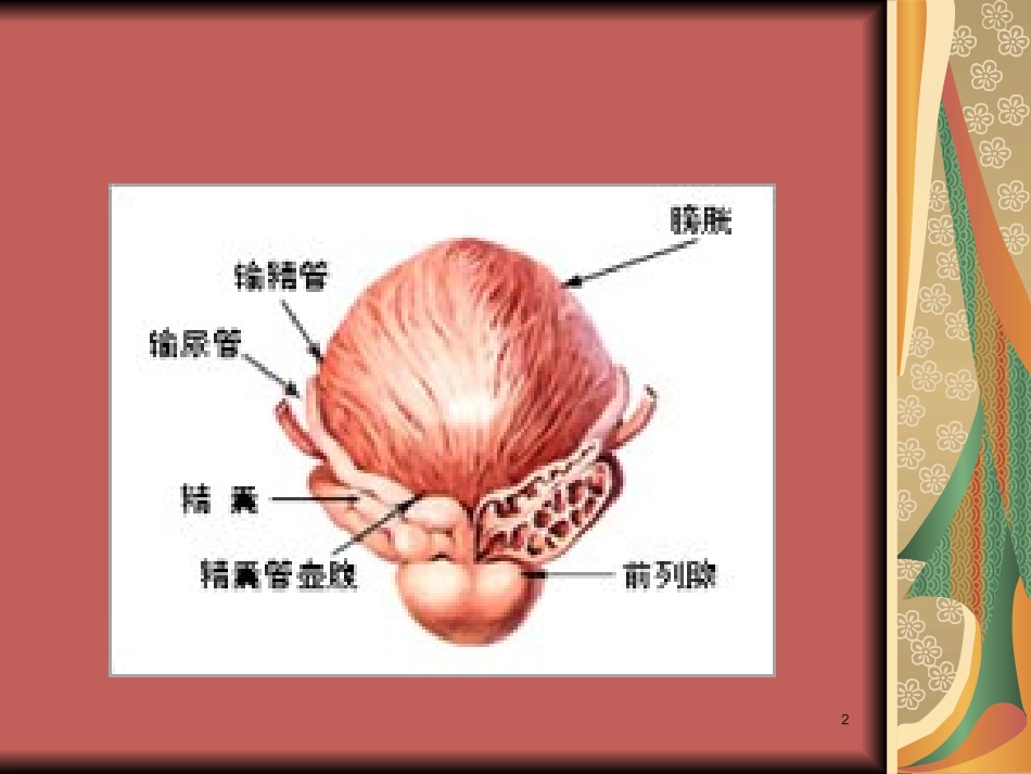 前列腺术后膀胱痉挛的相关因素课件_第2页