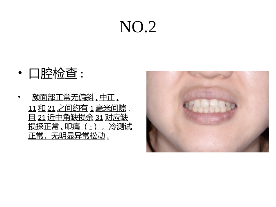 前牙美学树脂修复黄自印_第3页