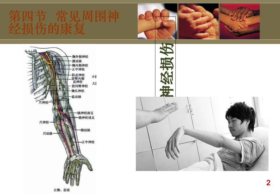 桡神经损伤讲解_第2页