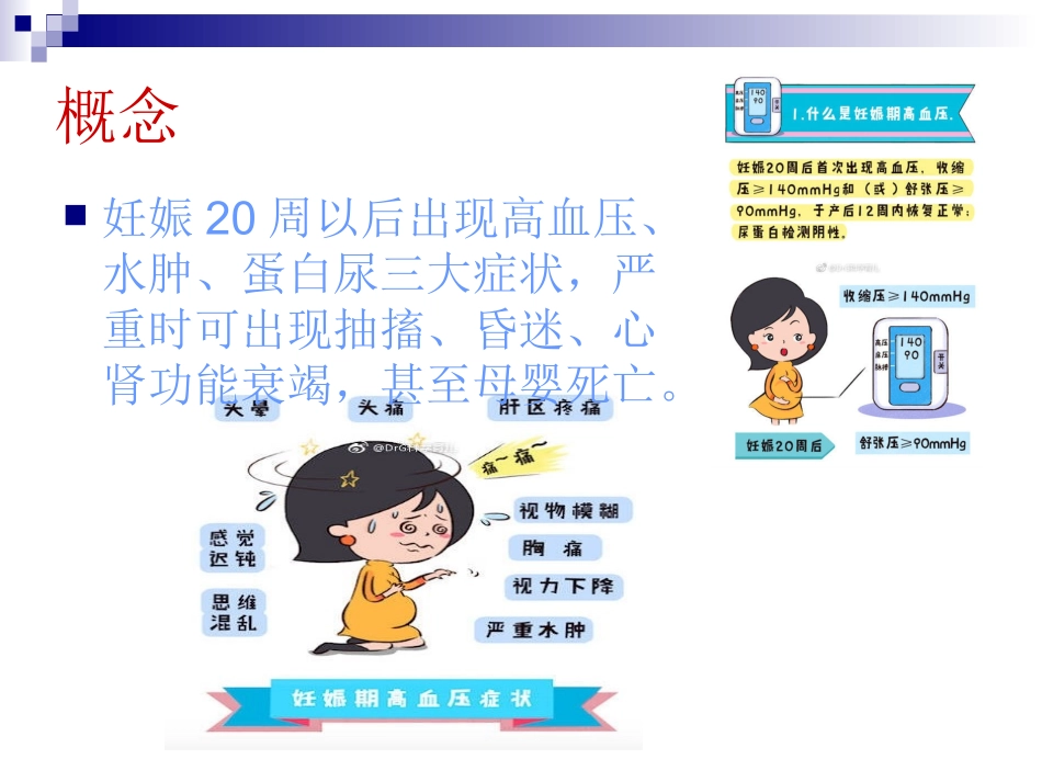 妊娠高血压护理大查房_第3页