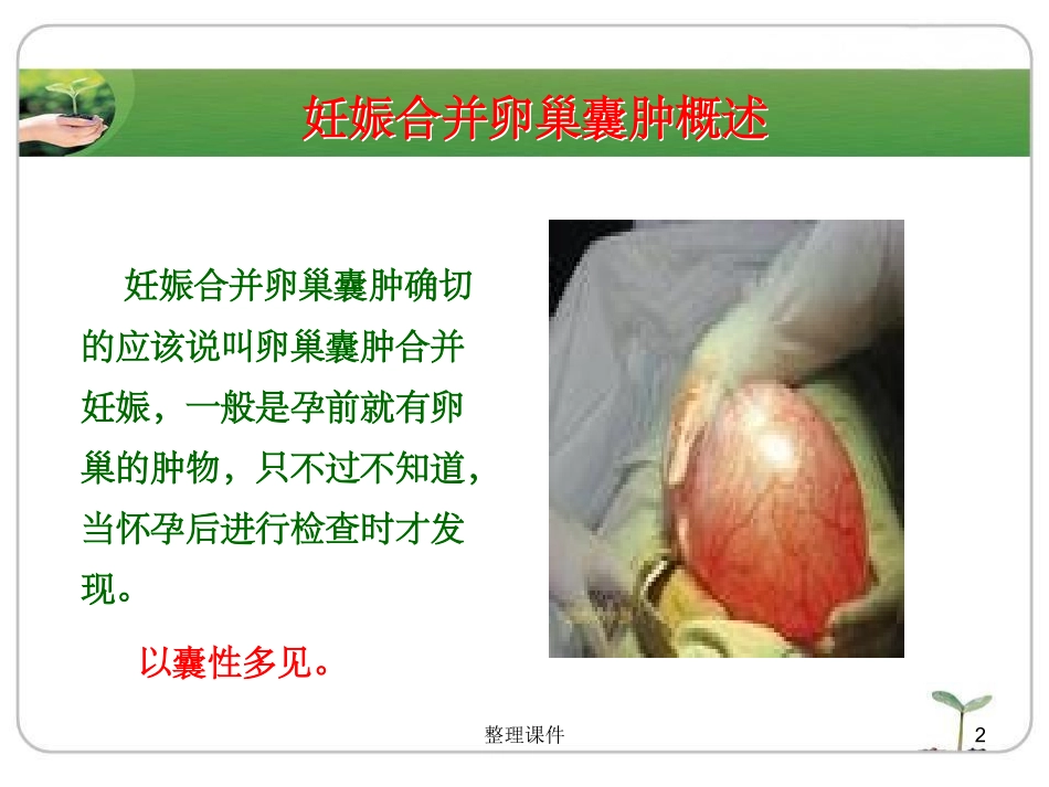 妊娠合并卵巢囊肿_第2页