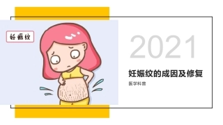 妊娠纹的成因及修复