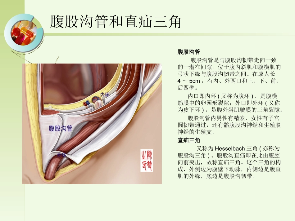 三月份护理查房腹股沟斜疝的护理查房_第3页